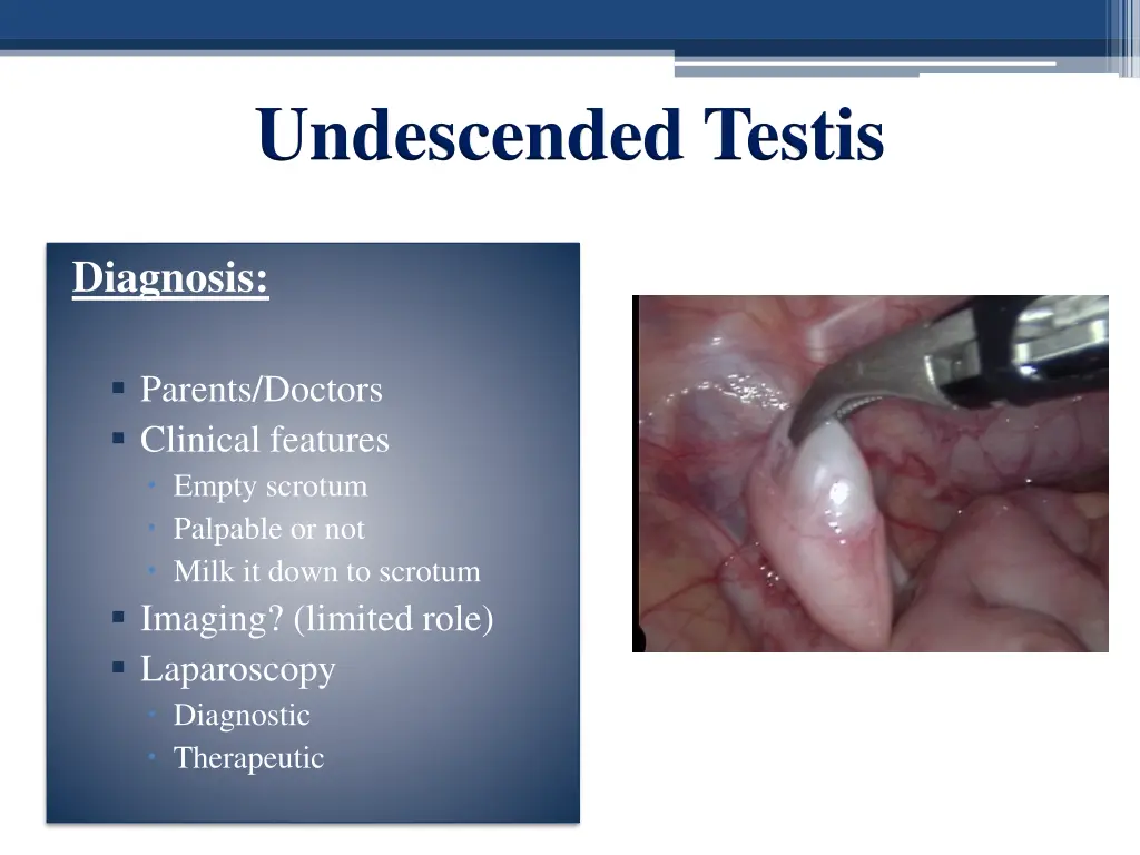 undescended testis 1