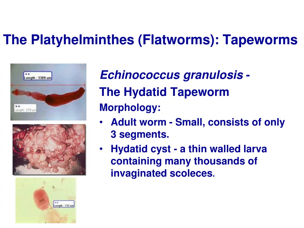 the platyhelminthes flatworms tapeworms 18