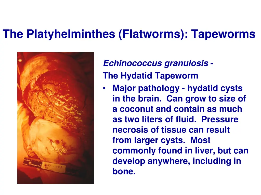 the platyhelminthes flatworms tapeworms 19