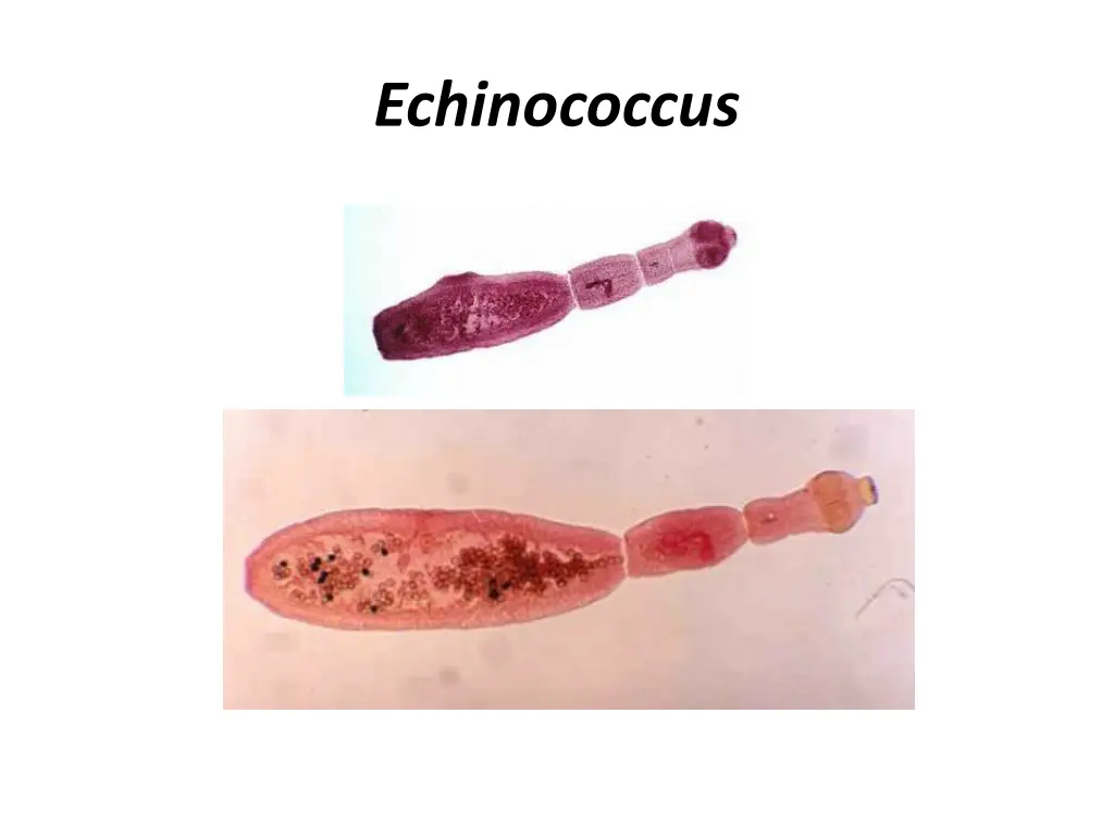 echinococcus 2