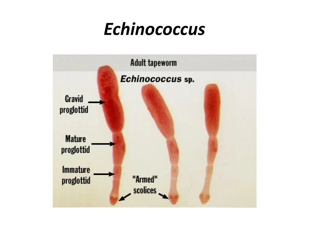 echinococcus 3