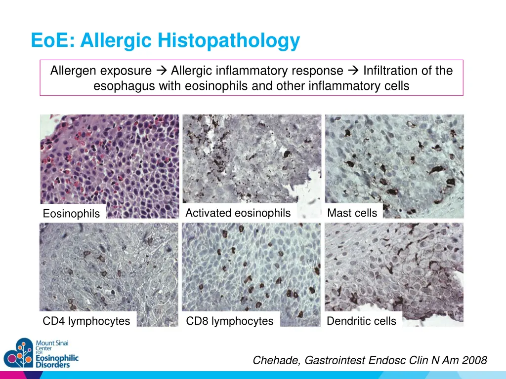 eoe allergic histopathology