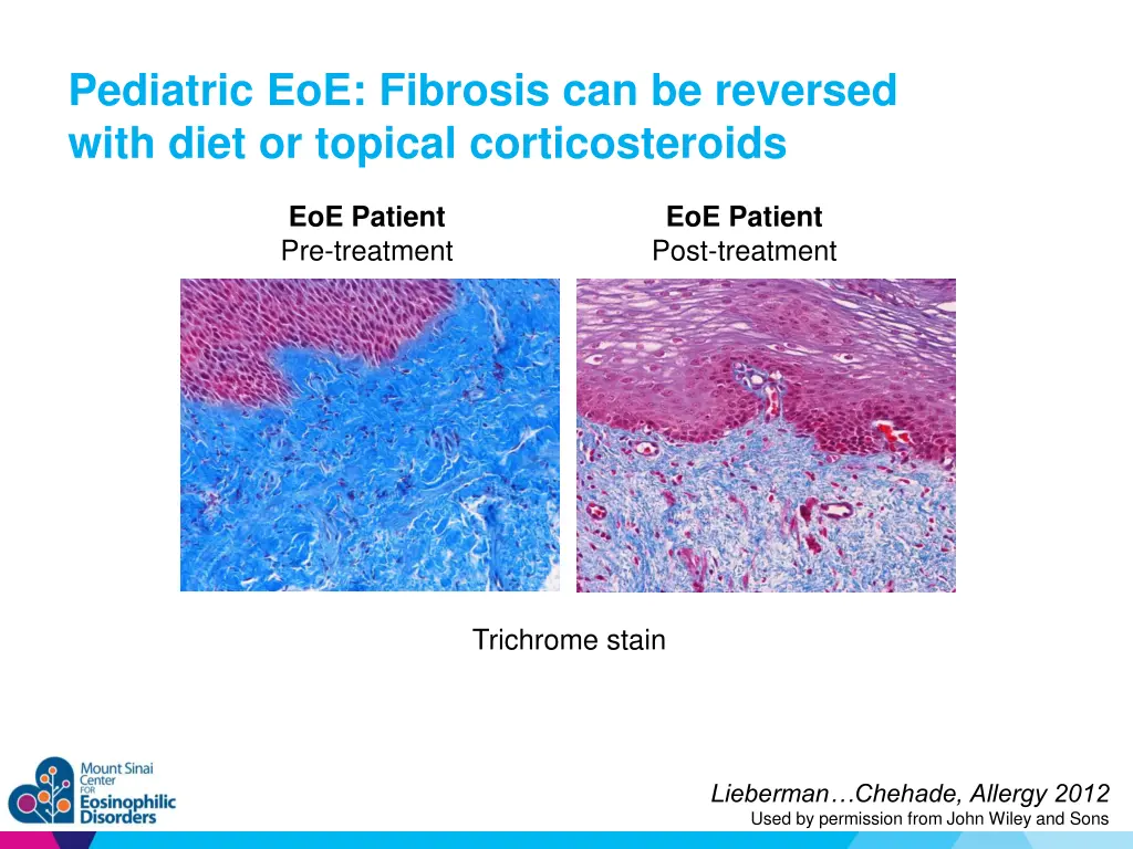 pediatric eoe fibrosis can be reversed with diet