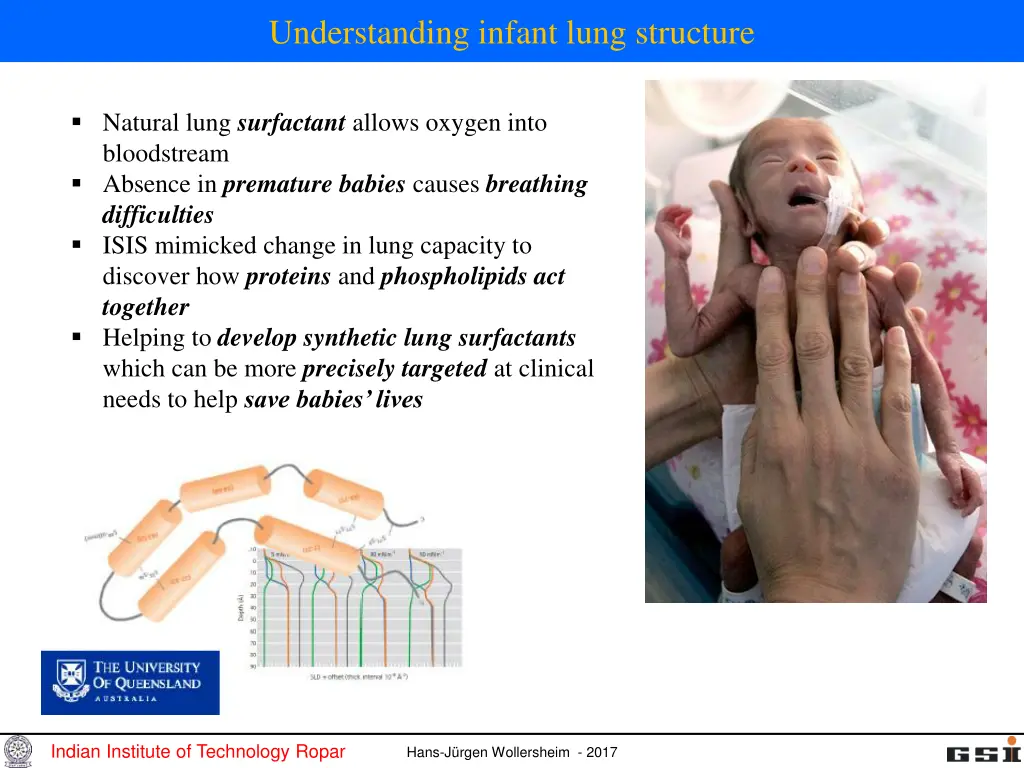 understanding infant lung structure