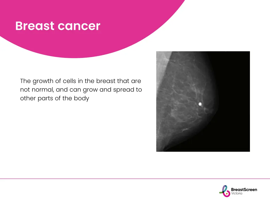 breast cancer