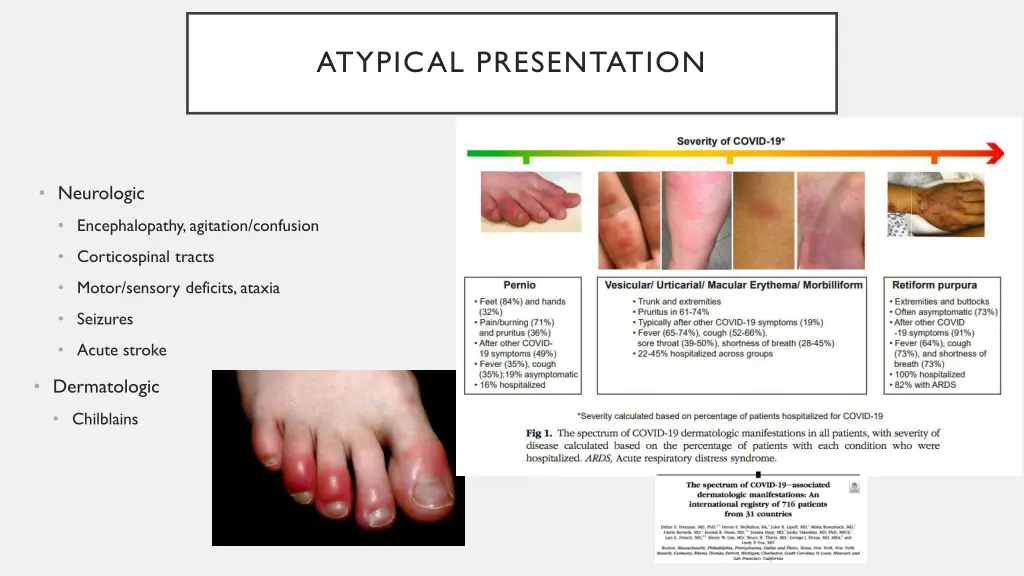 atypical presentation