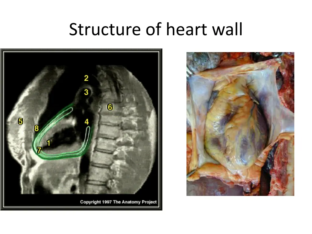 structure of heart wall