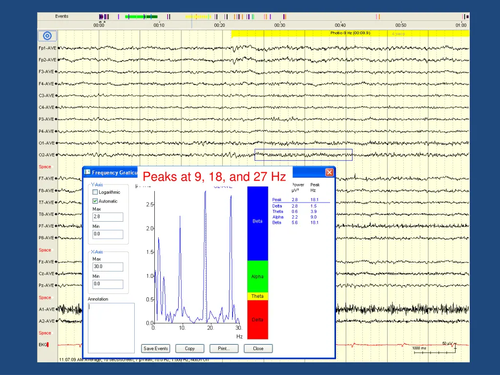 peaks at 9 18 and 27 hz