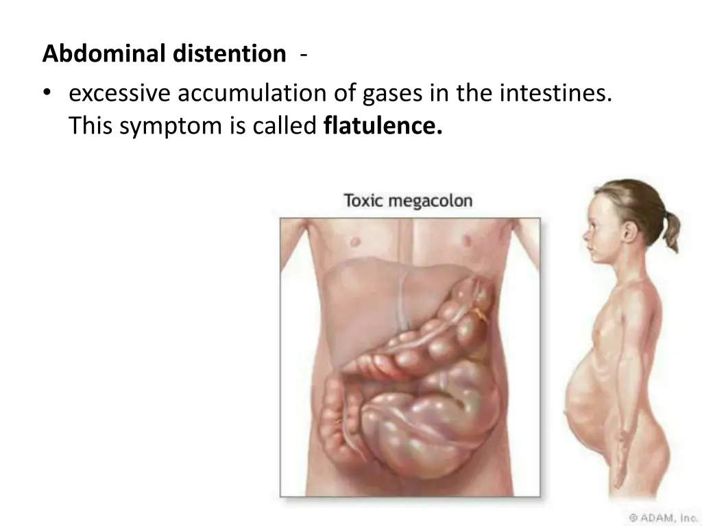 abdominal distention excessive accumulation