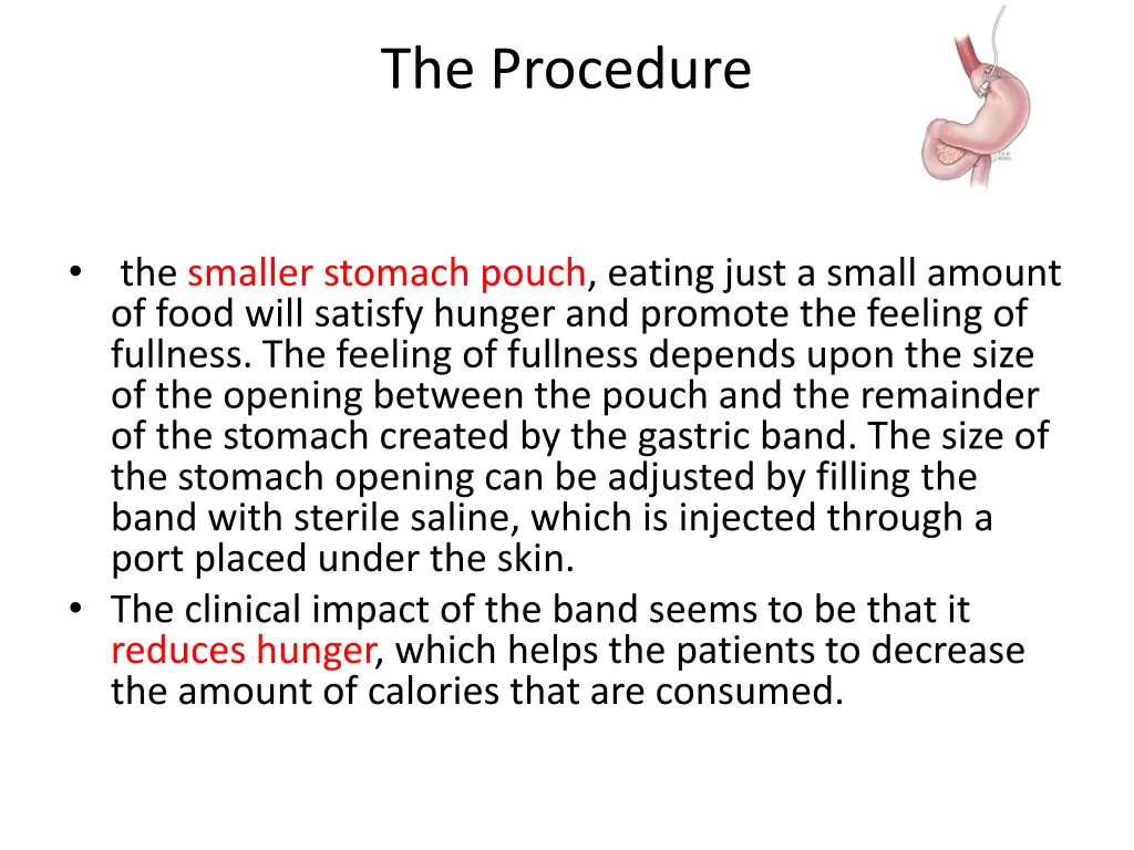 the procedure 1