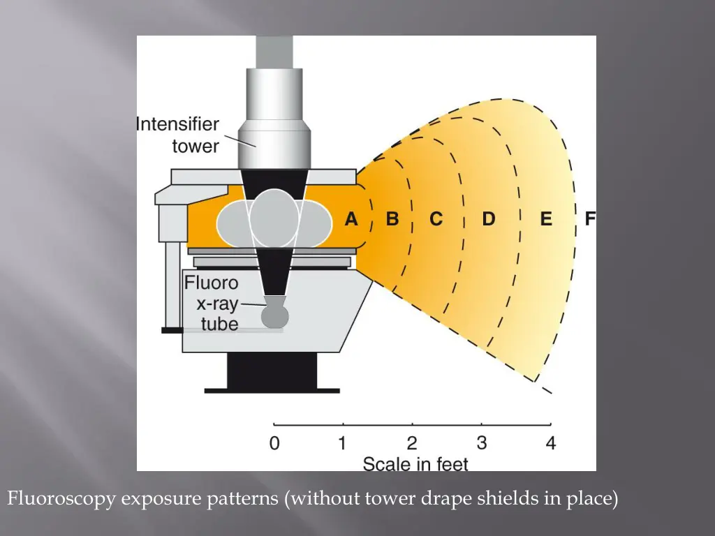 fluoroscopy exposure patterns without tower drape