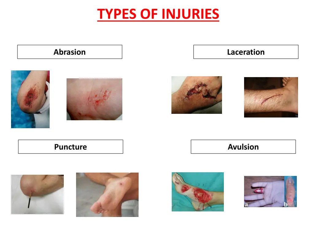 types of injuries