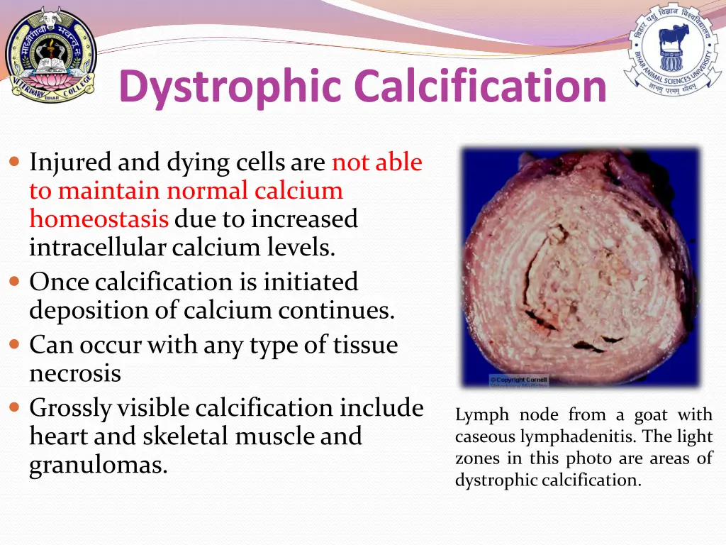 dystrophic calcification