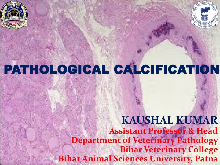 pathological calcification pathological