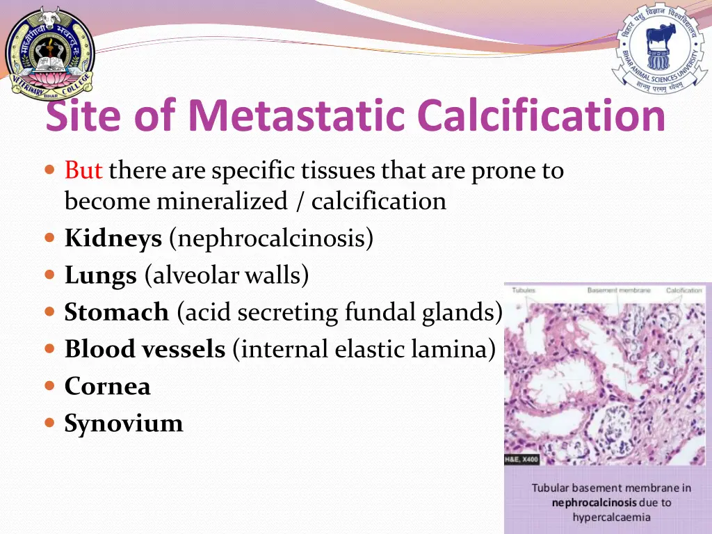 site of metastatic calcification