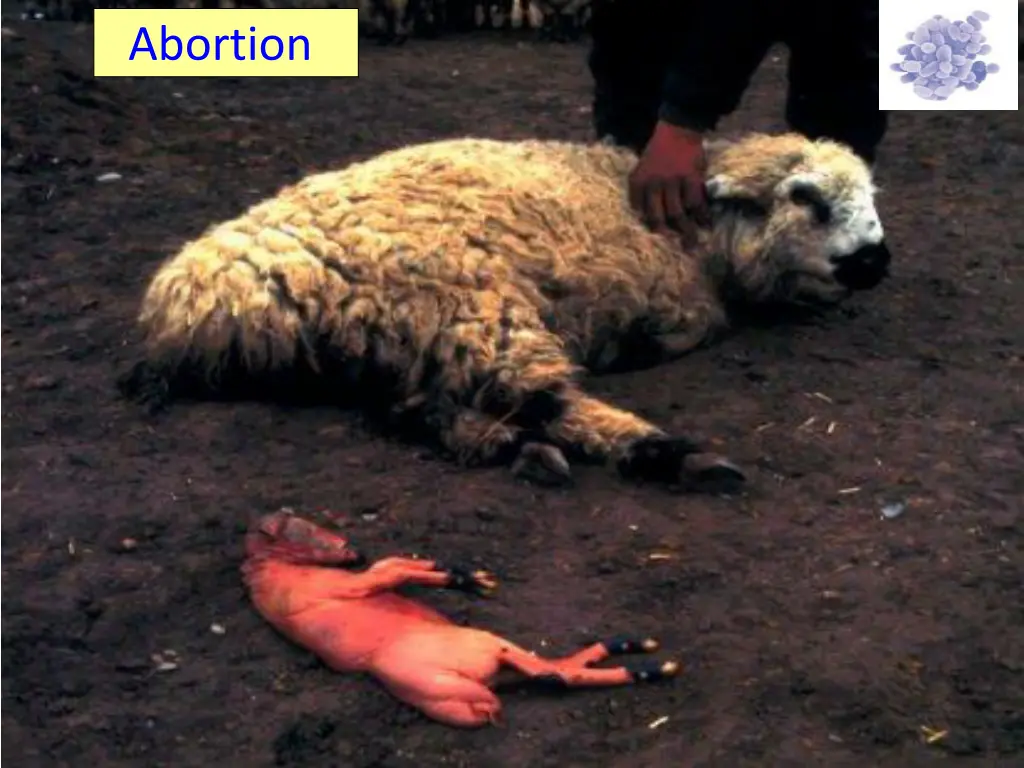 abortion