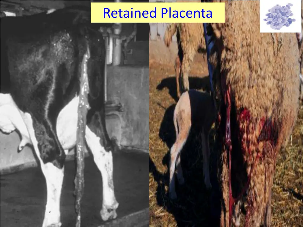 retained placenta