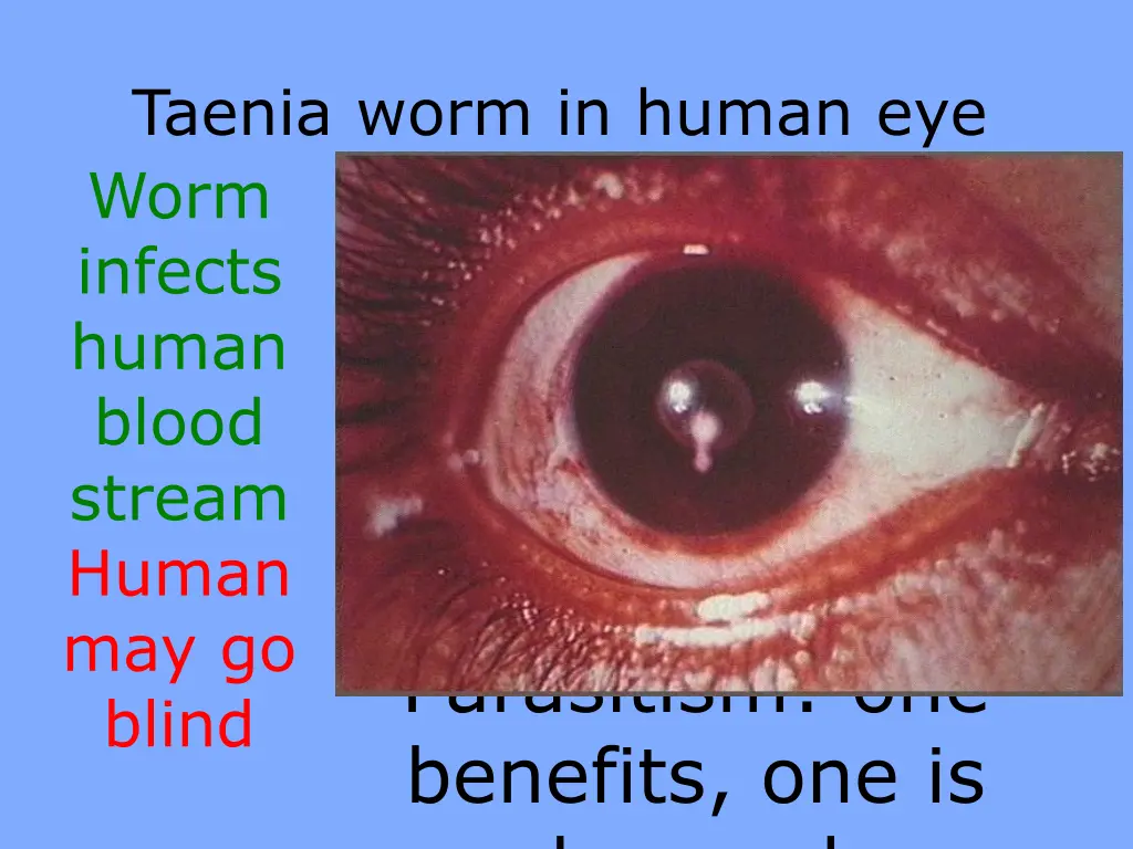 taenia worm in human eye worm infects human blood