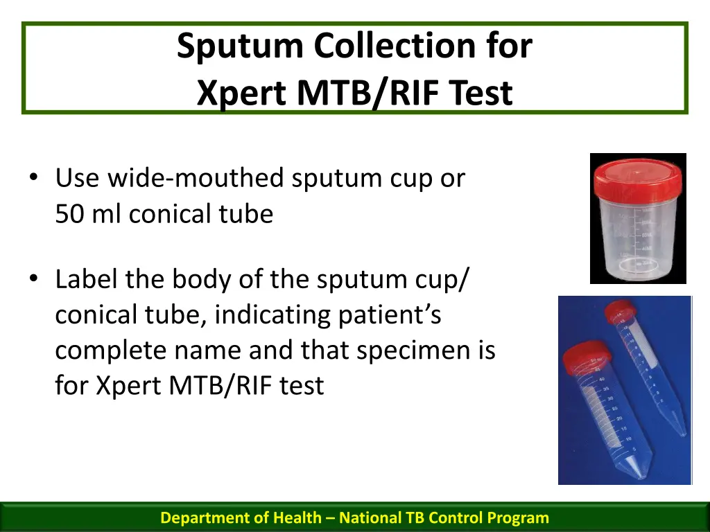 sputum collection for xpert mtb rif test