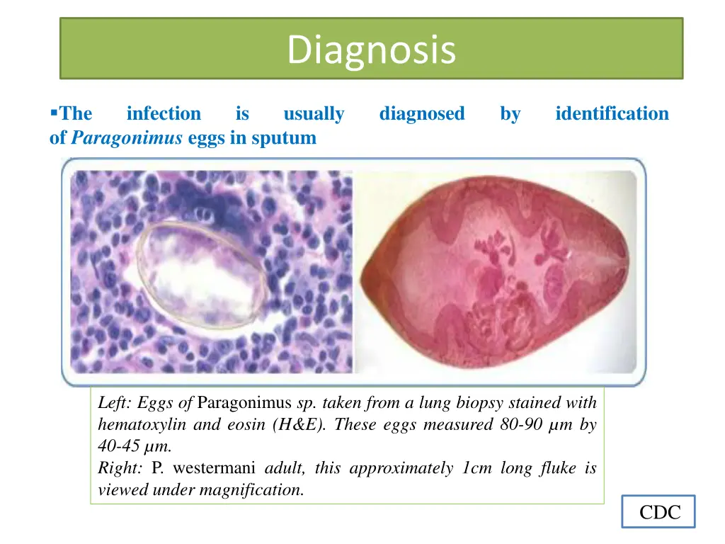 diagnosis