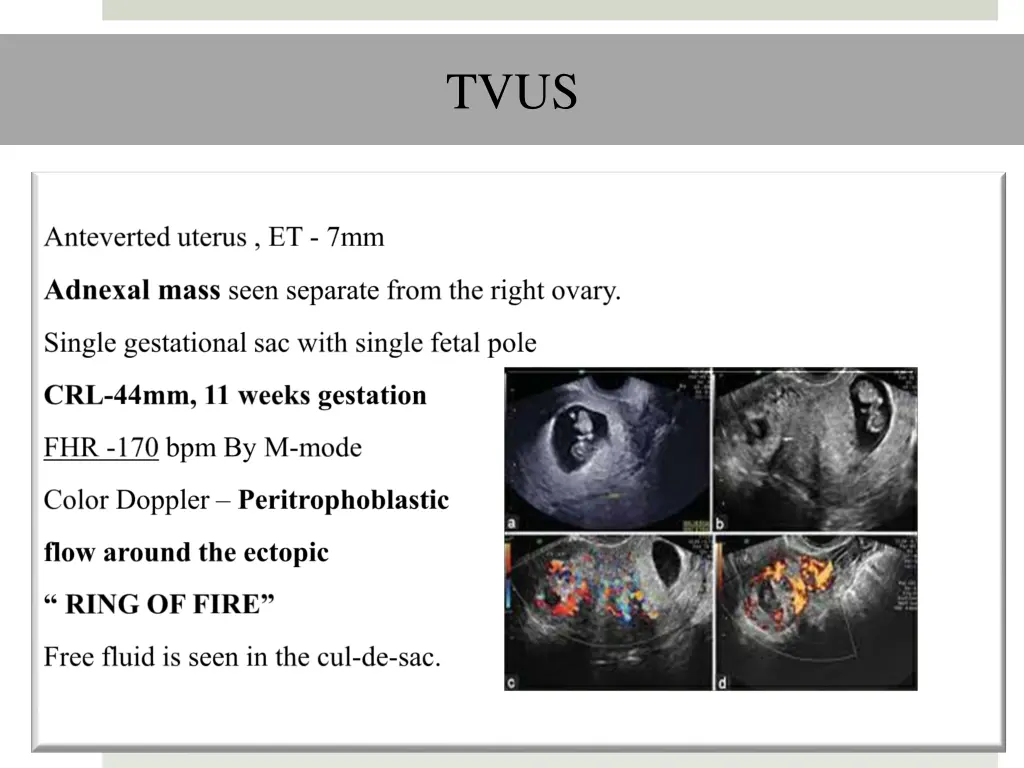 slide9