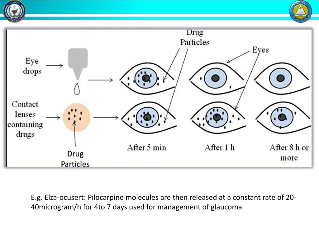 e g elza ocusert pilocarpine molecules are then