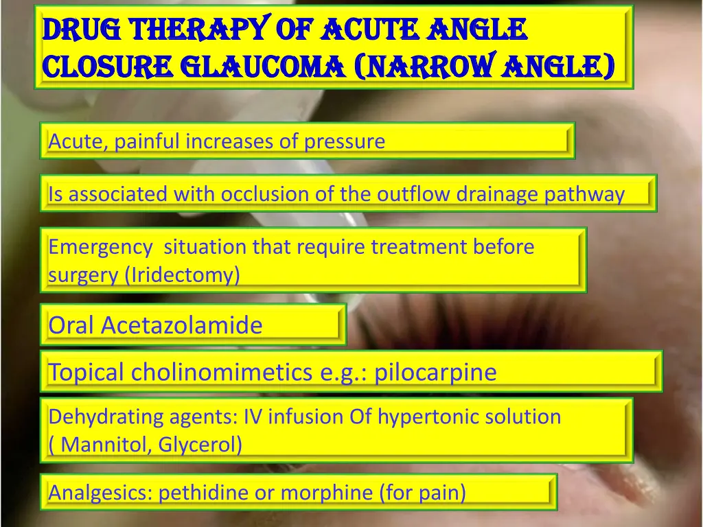 drug therapy of acute angle drug therapy of acute