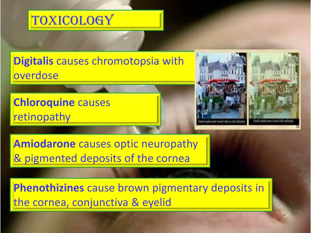 toxicology