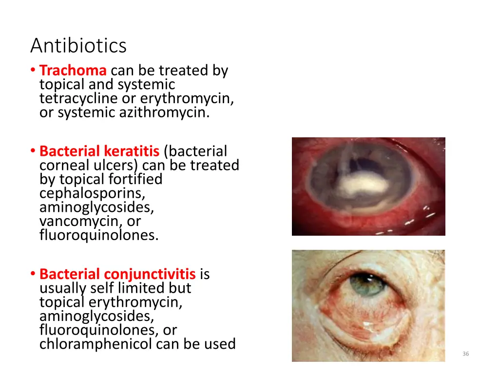 antibiotics trachoma can be treated by topical