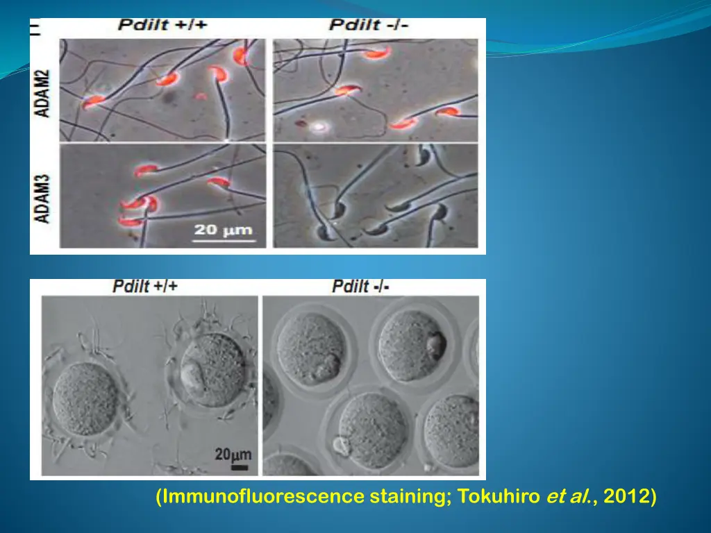 immunofluorescence staining tokuhiro et al 2012