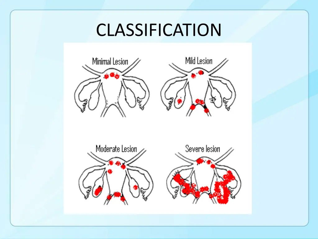 classification 1