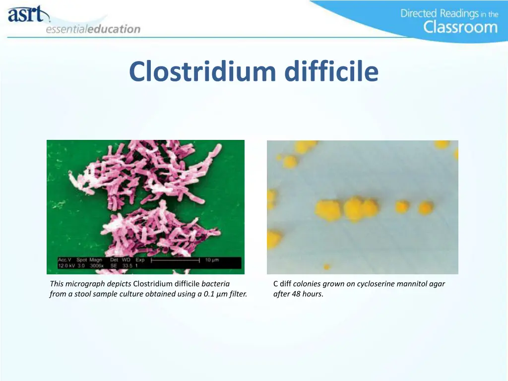 clostridium difficile 1