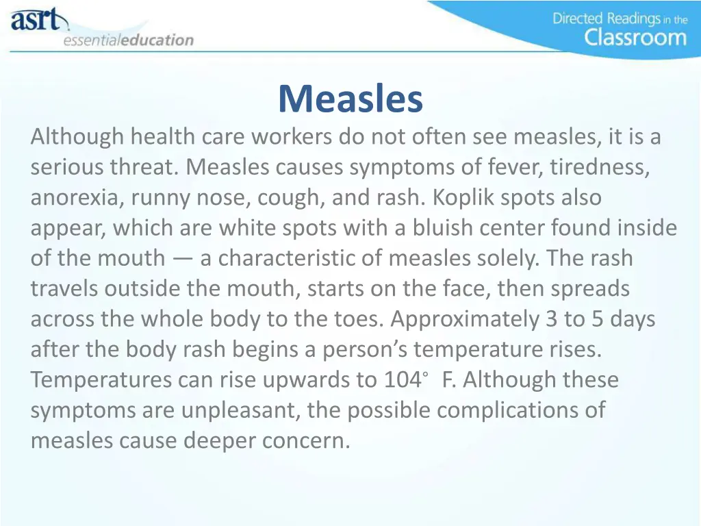 measles