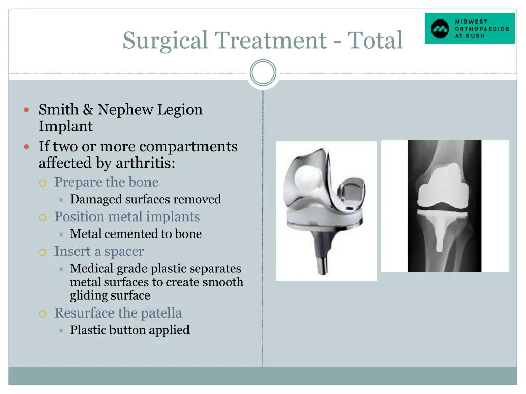 surgical treatment total