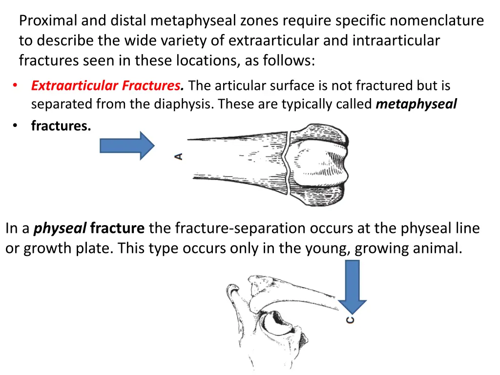 proximal and distal metaphyseal zones require