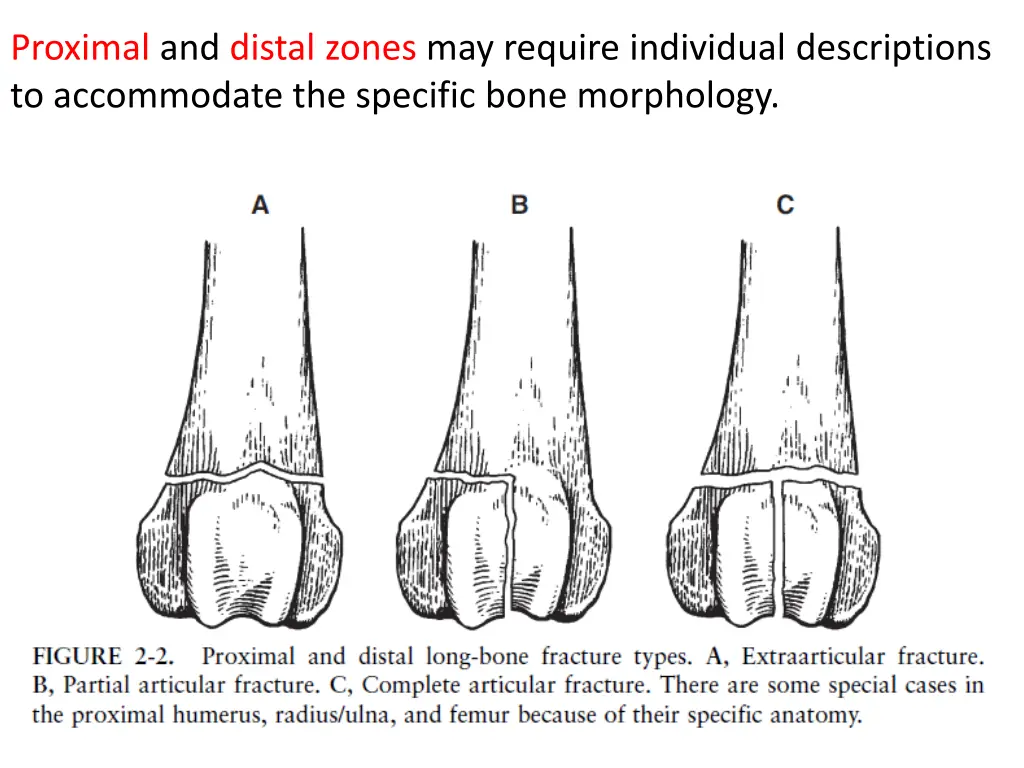 proximal and distal zones may require individual