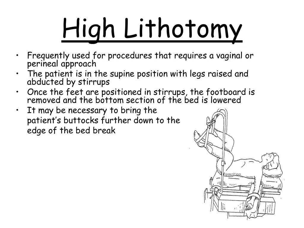 high lithotomy