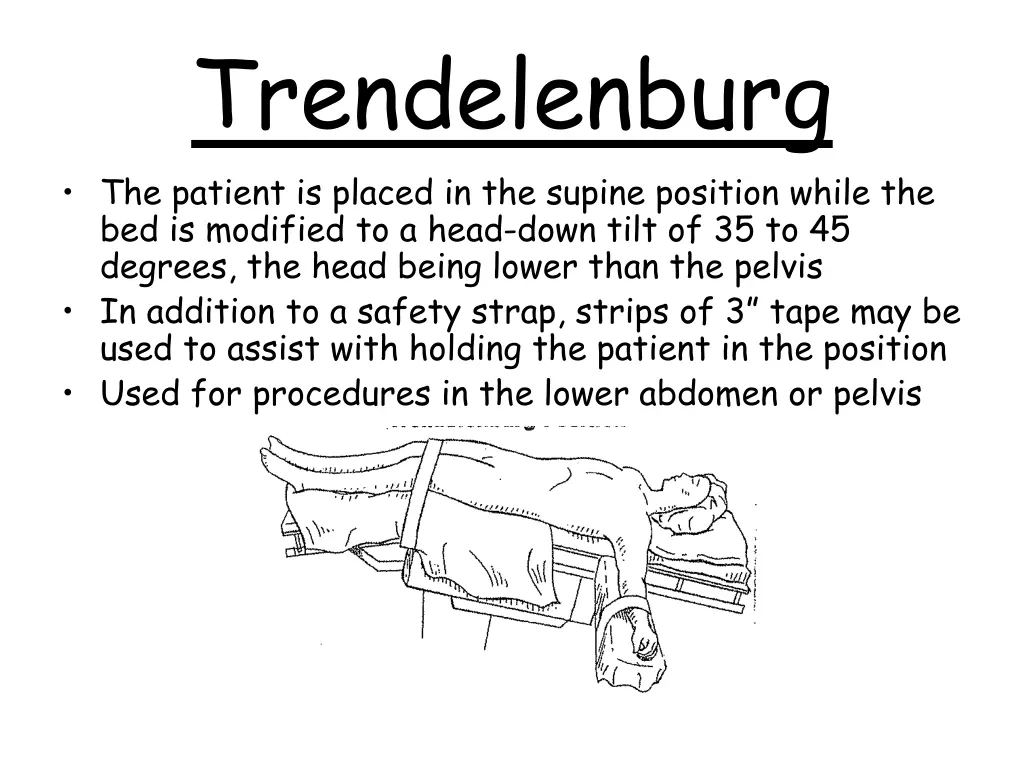 trendelenburg the patient is placed in the supine