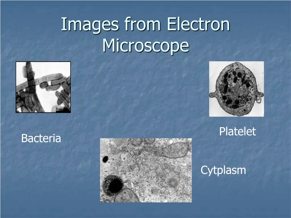 images from electron microscope