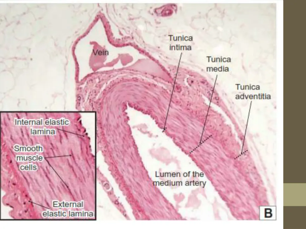 slide7