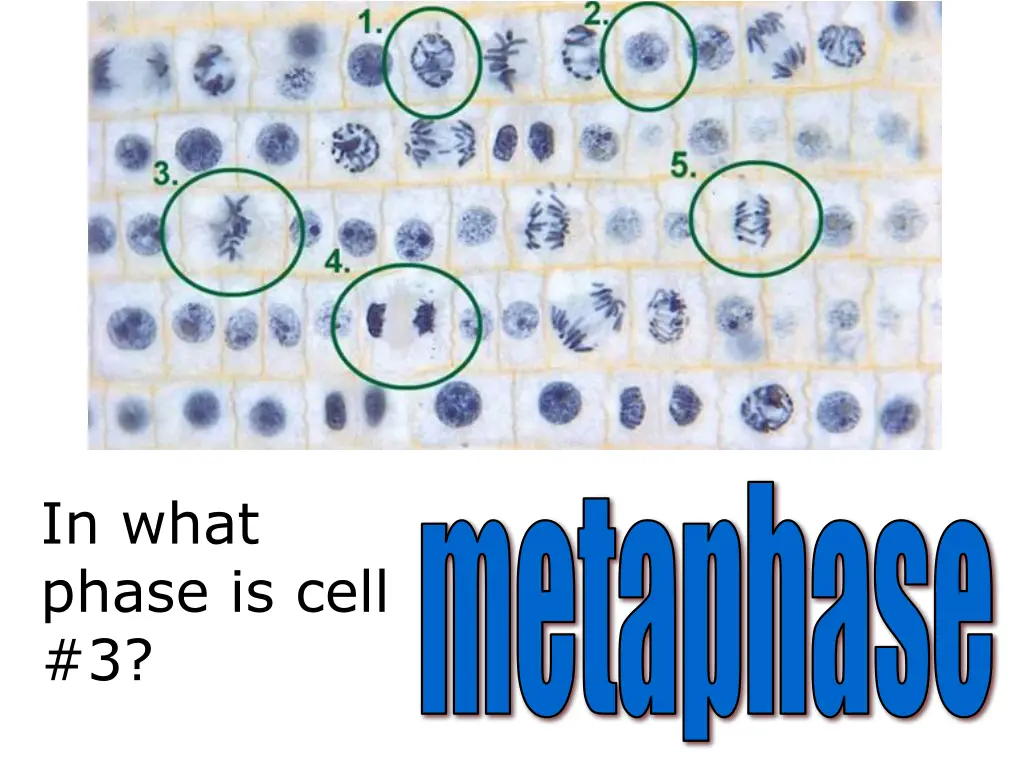 metaphase