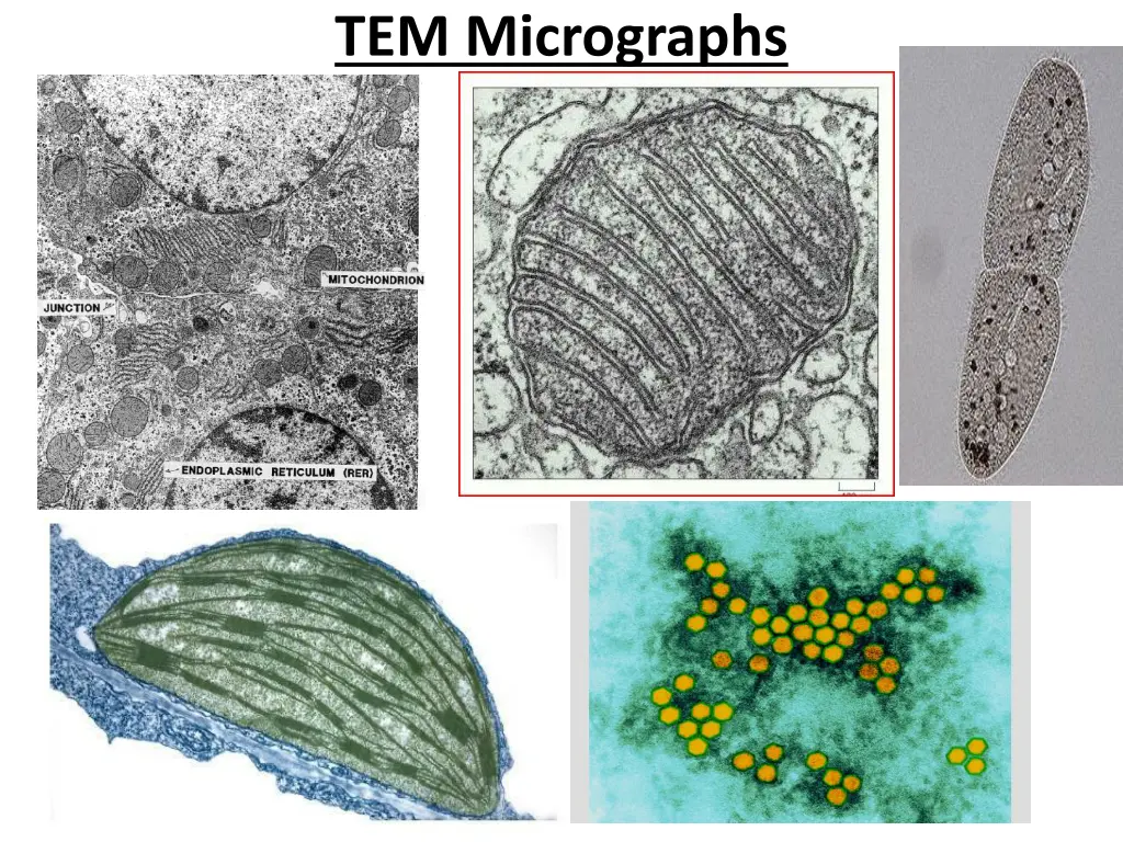 tem micrographs