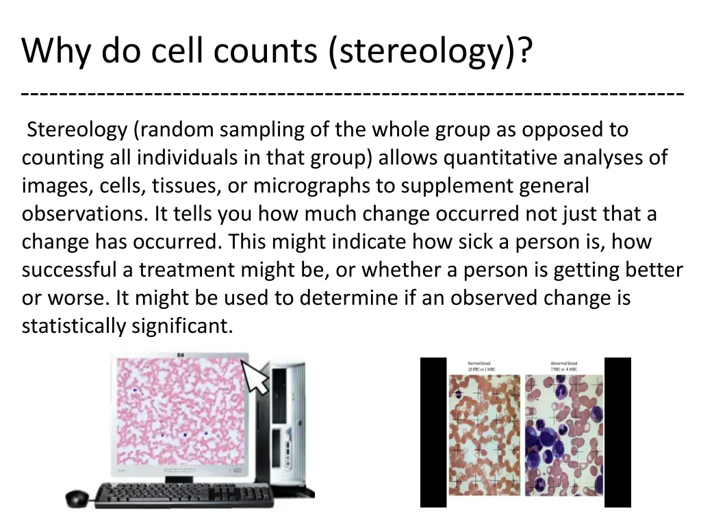 why do cell counts stereology stereology random