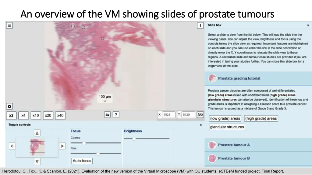 an overview of the vm showing slides of prostate