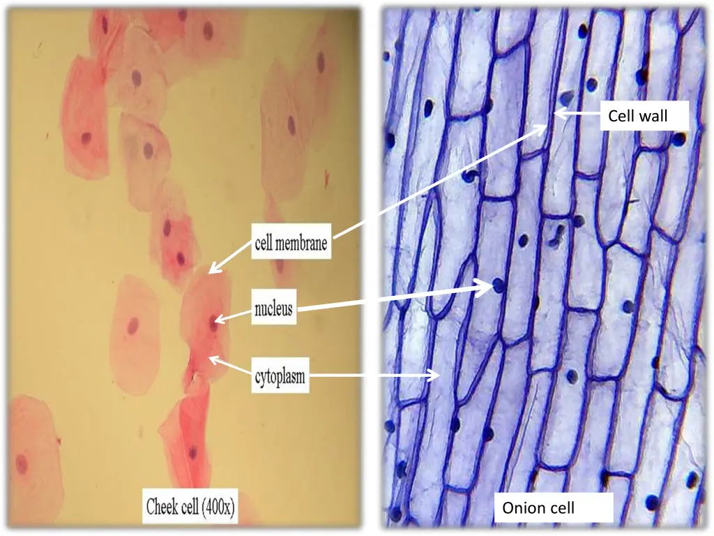 cell wall