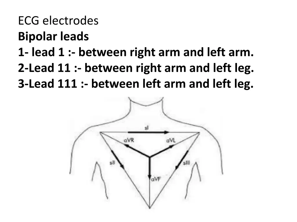 ecg electrodes bipolar leads 1 lead 1 between