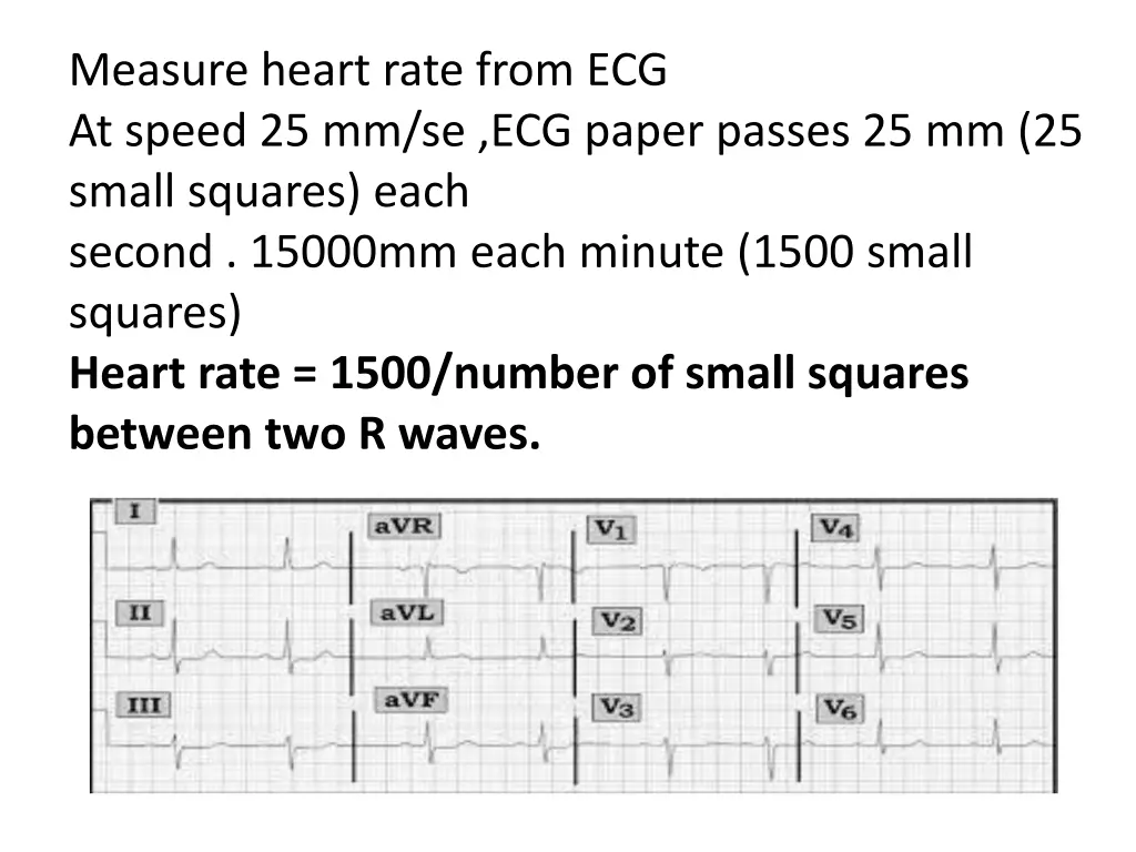 measure heart rate from ecg at speed