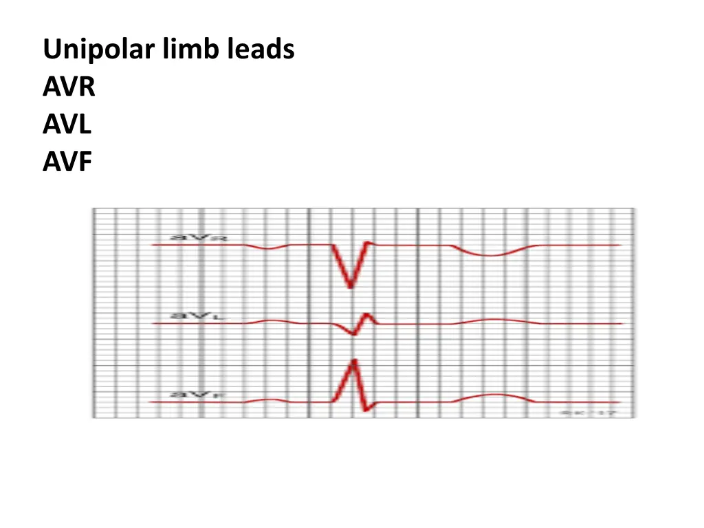 unipolar limb leads avr avl avf