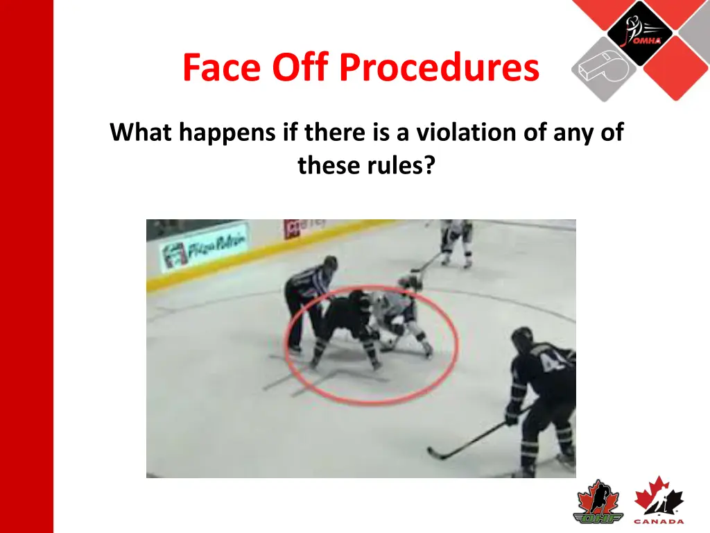 face off procedures 5