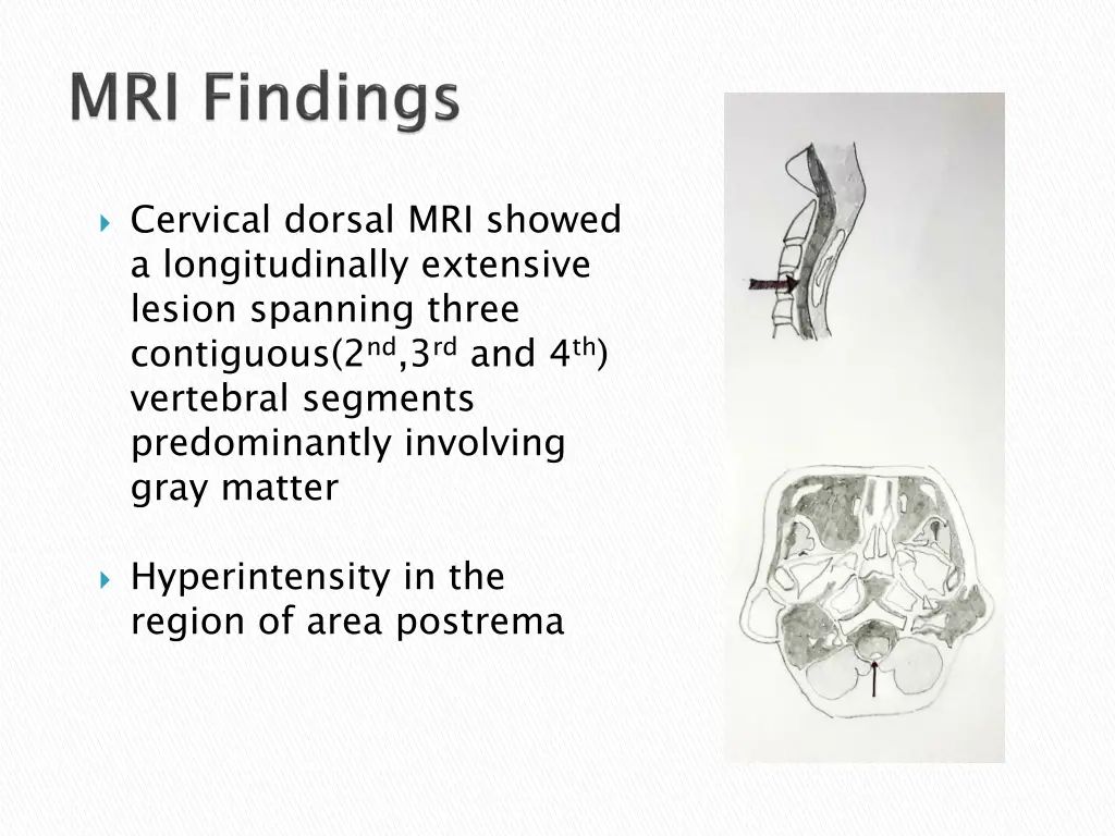 cervical dorsal mri showed a longitudinally